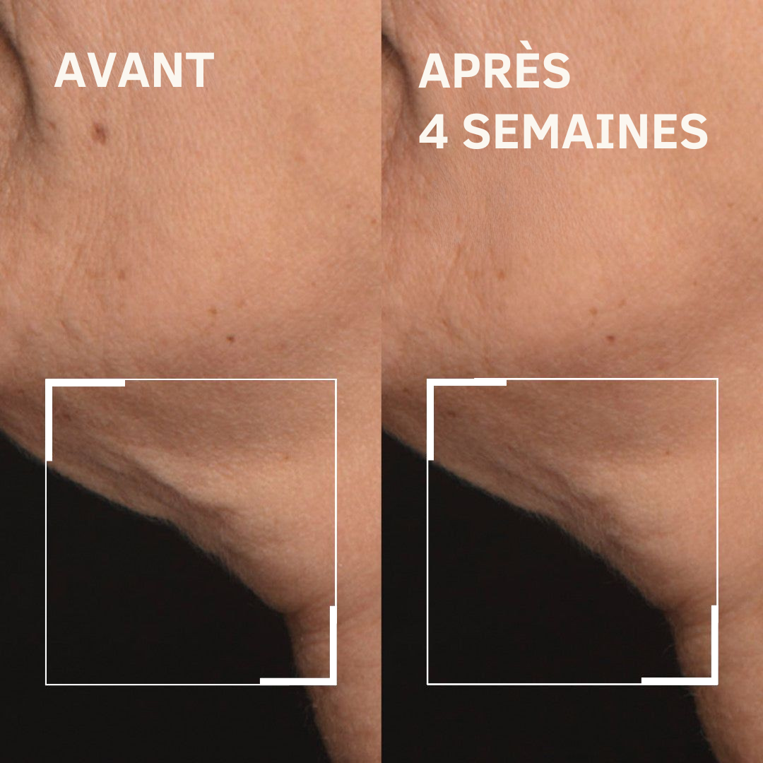 Crème Raffermissante & Liftante Cou Meyora AH-8 | Soin Anti-Âge aux Peptides 120g