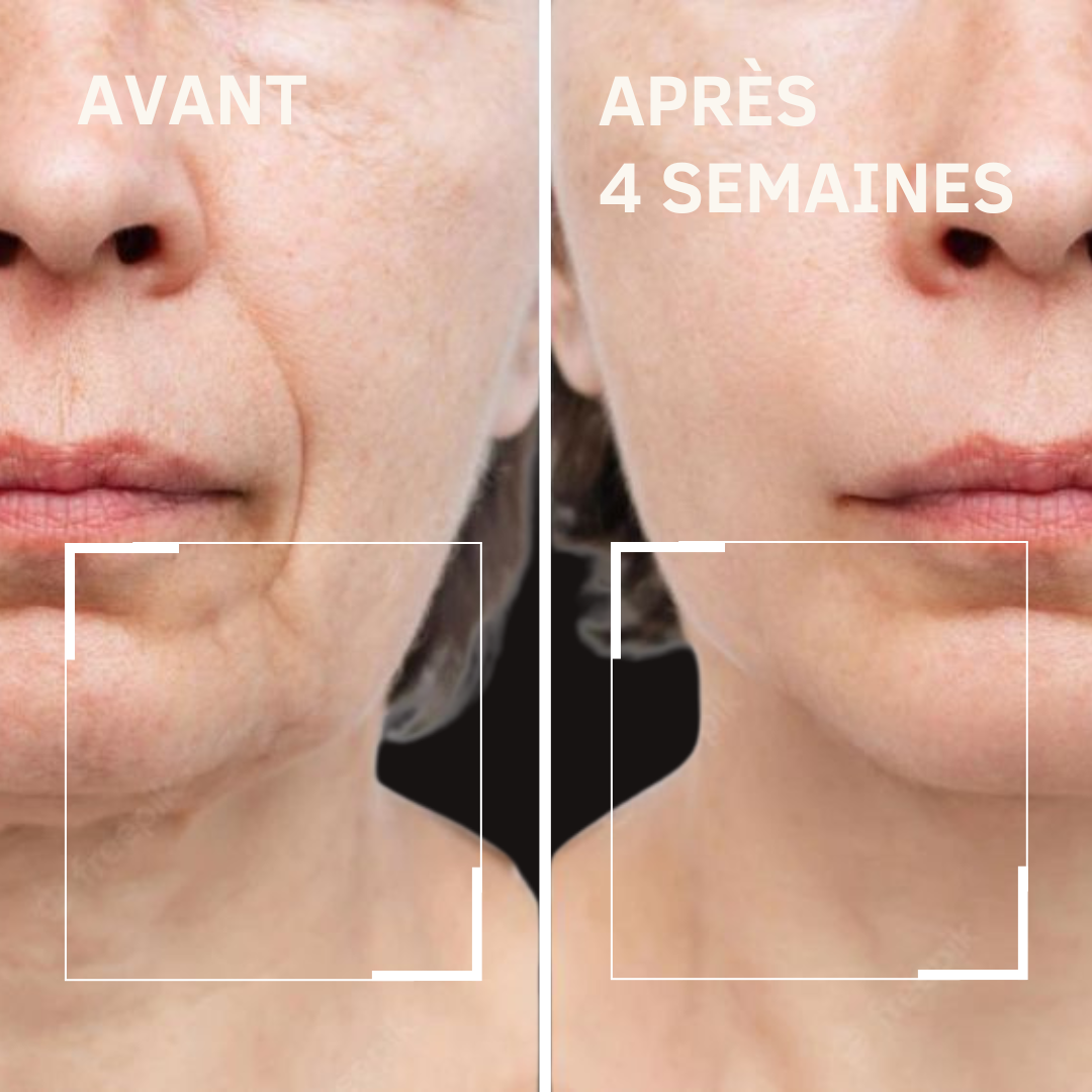Crème Raffermissante & Liftante Cou Meyora AH-8 | Soin Anti-Âge aux Peptides 120g